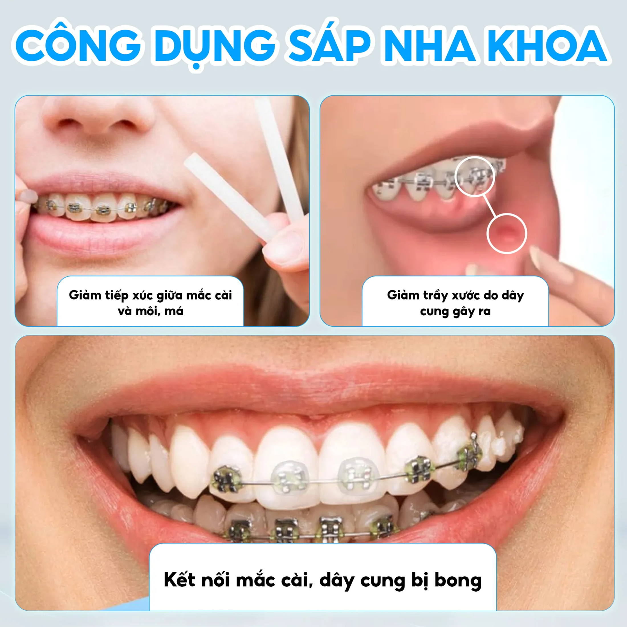 Công dụng sáp nha khoa GUM